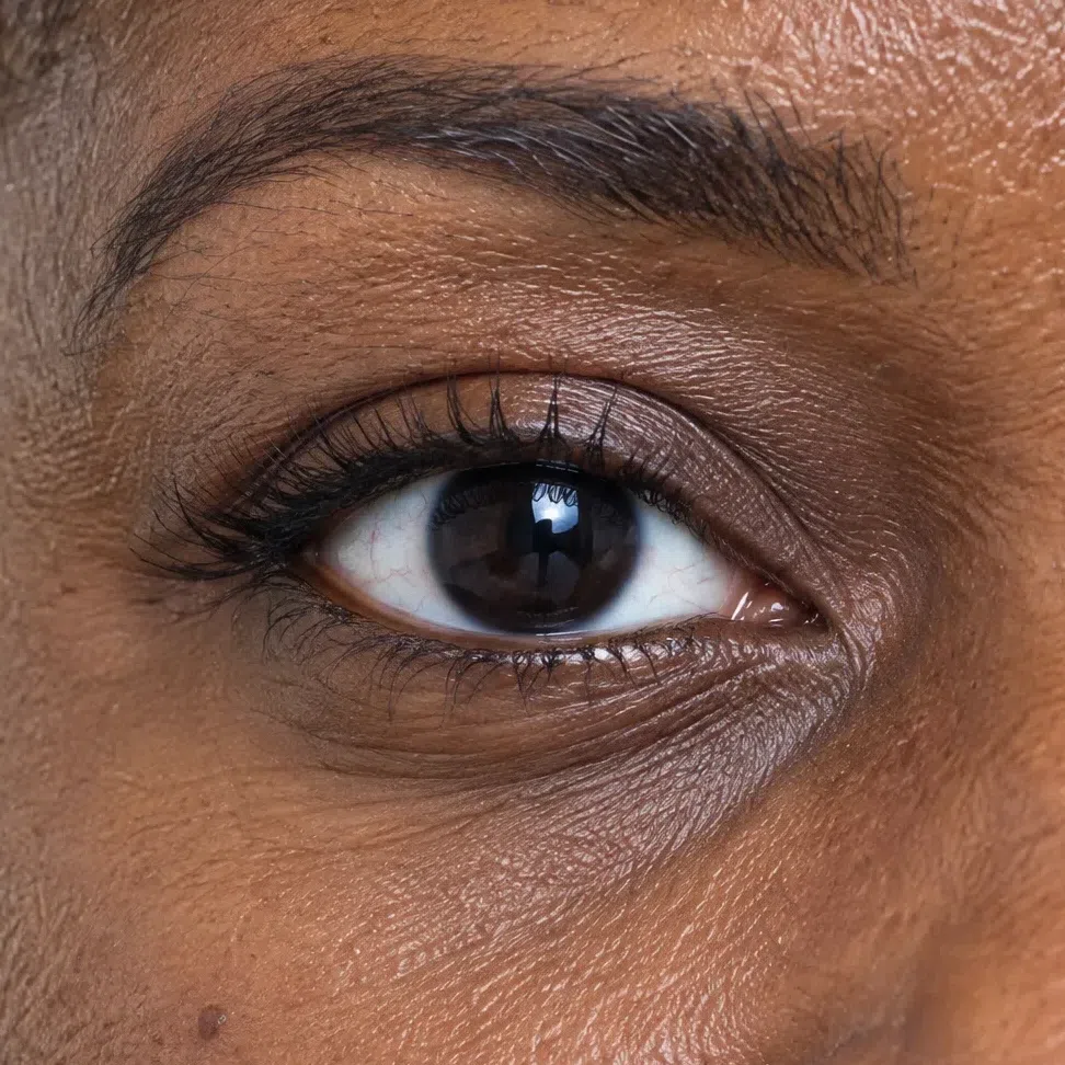 A glossy near-black iris set in a brilliantly white sclera on a deep brown complexion
