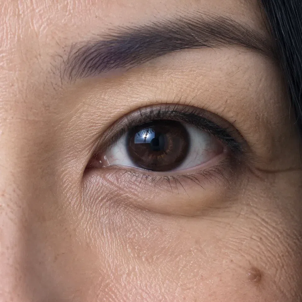 A cool dark brown iris with fine lighter rays around the pupil