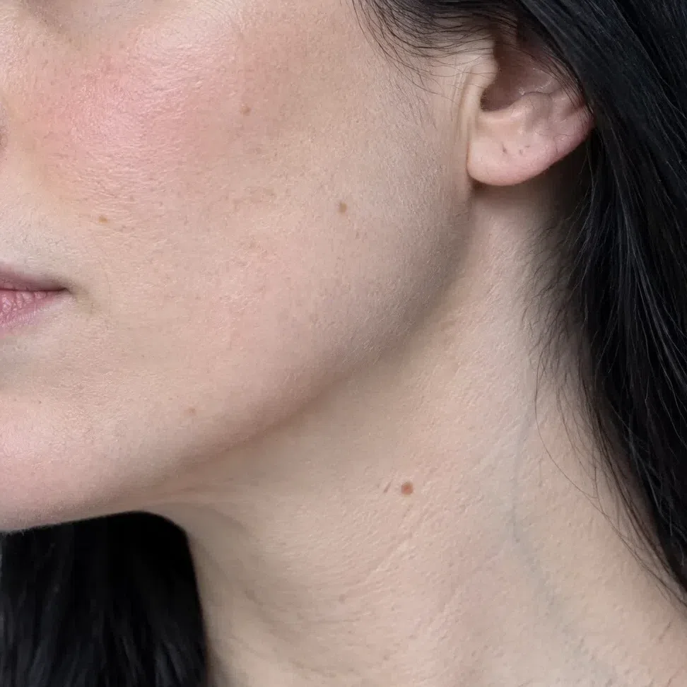 The jaw and neck of a fair Bright Winter: cool pink porcelain with faint blue veins under the thin skin
