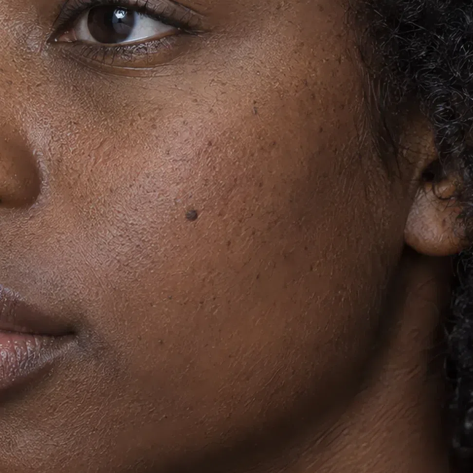 Ash-toned freckles and a mole on deep brown Cool Summer skin