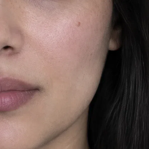 Neutral beige Deep Winter cheek skin with a berry flush and gray-brown freckles