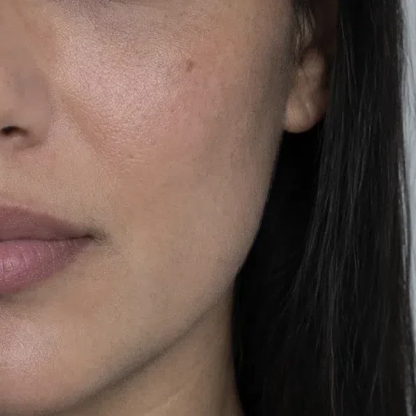 Olive Deep Winter cheek skin tanned to a cool olive-brown