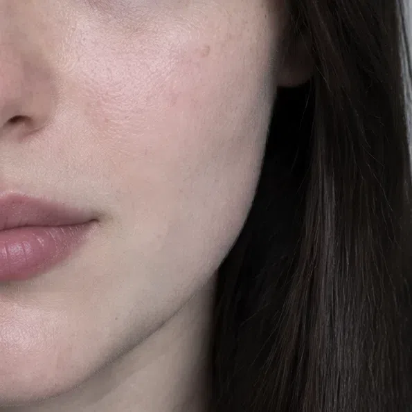 Fair porcelain Deep Winter cheek skin with a cool pink cast and faint blue veins