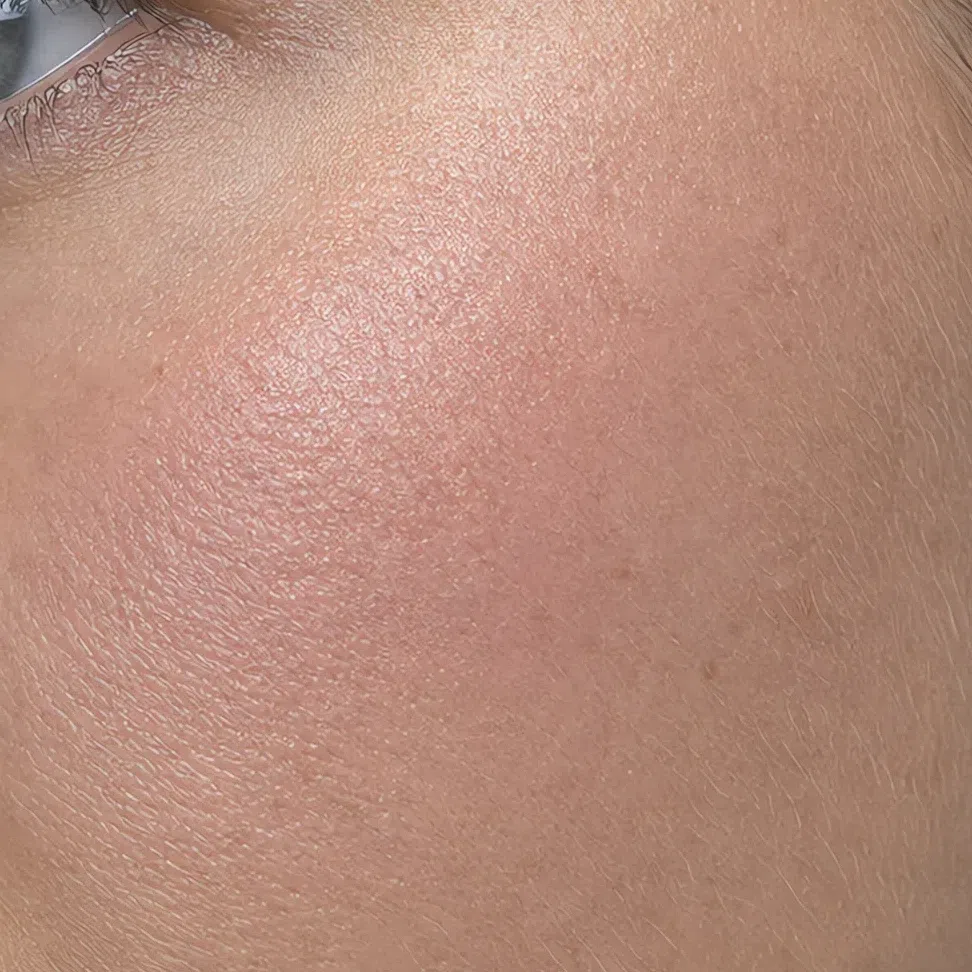 Cream blush sunk into the skin with the texture visible through it