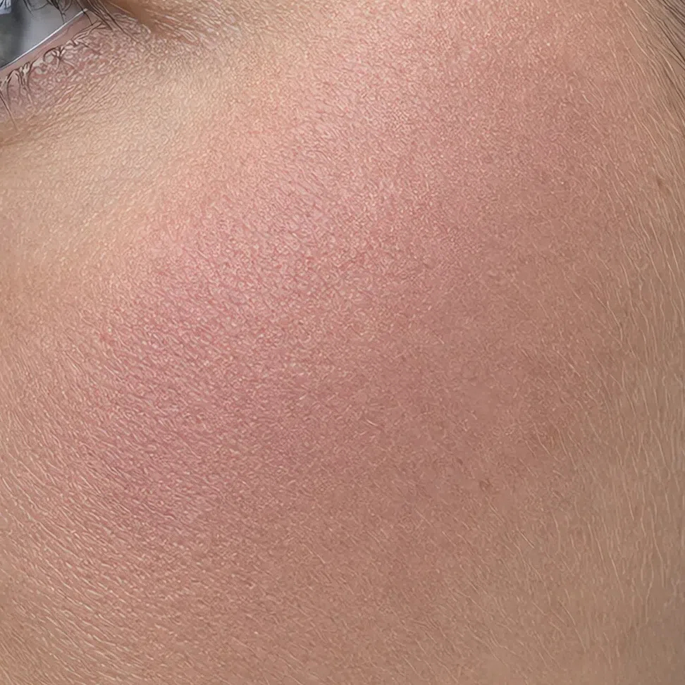 Powder blush sitting on top of the skin as a distinct layer with a visible edge