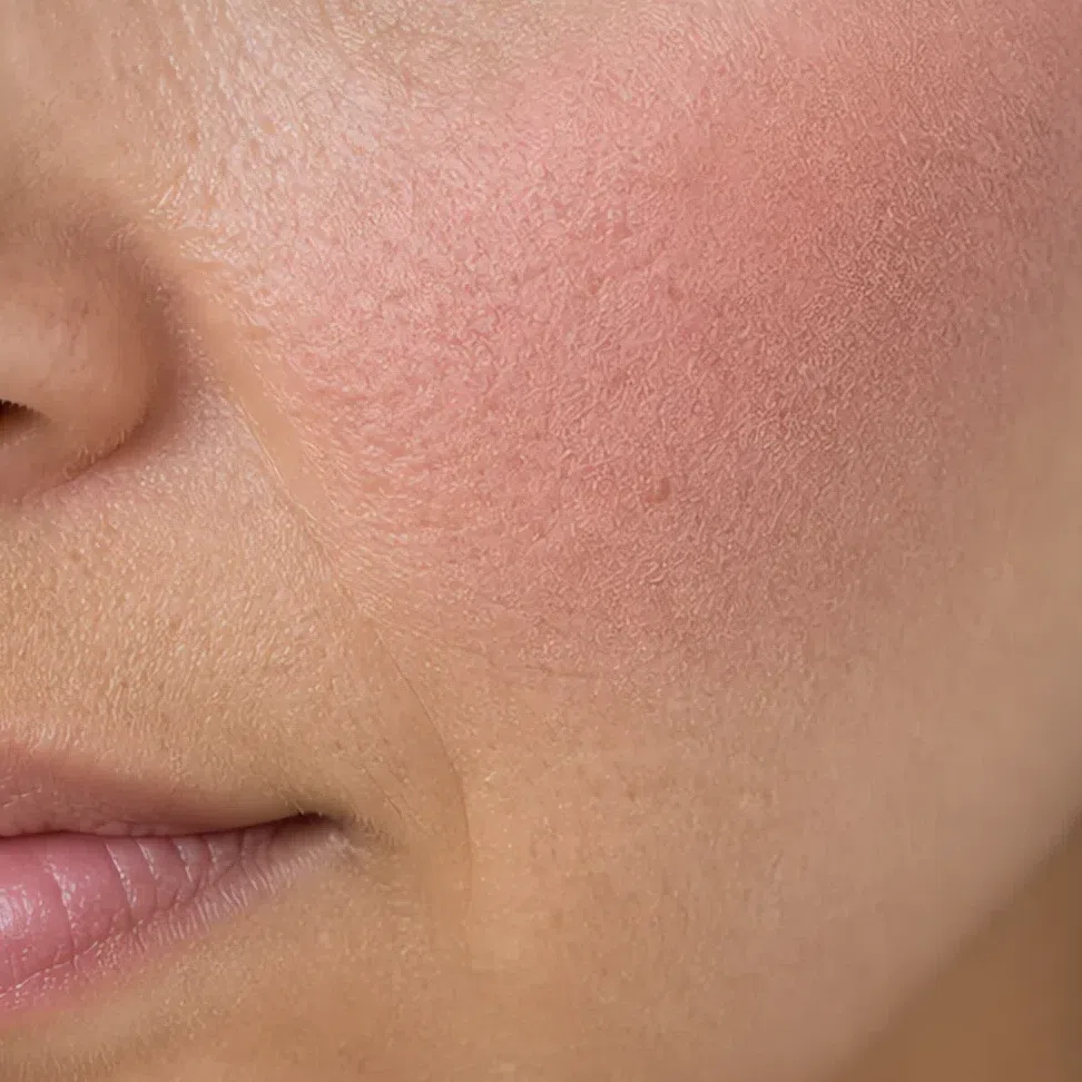 Powder blush sitting on top of the skin as a distinct layer with a visible edge