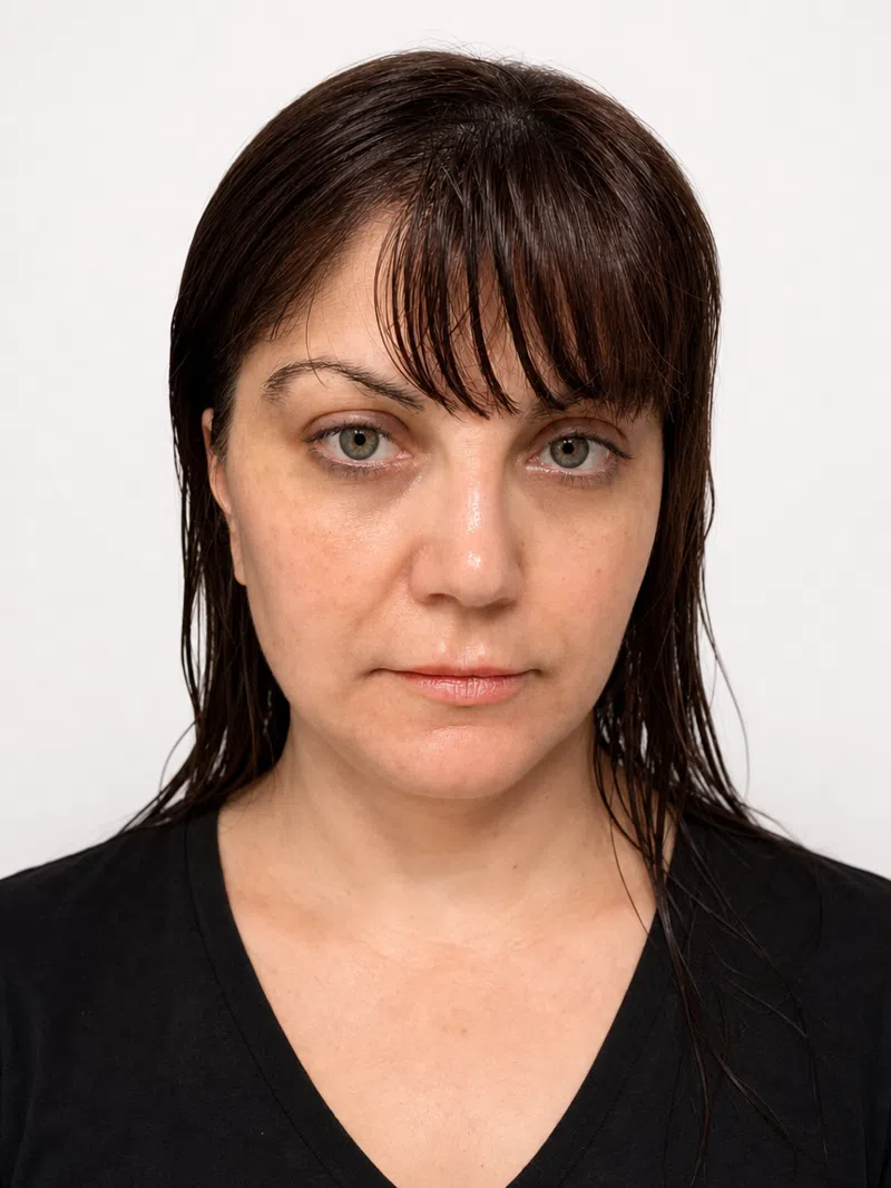 Front-view face analysis of a woman: symmetry and proportion markup before the analysis