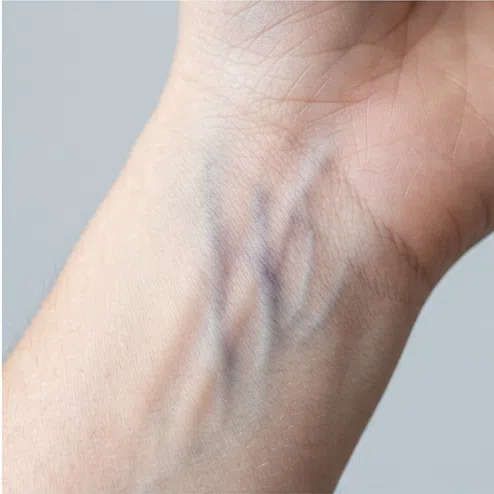 Blue and purple veins on the wrist - a cool skin undertone